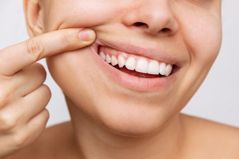Complete Guide to Healthy Teeth and Gums